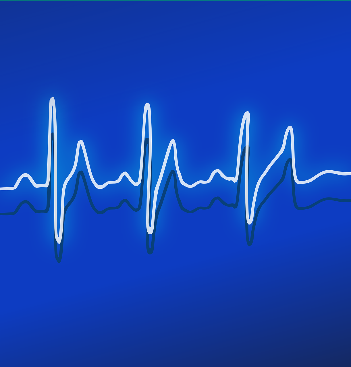 ekg, heartbeat, frequency-158177.jpg